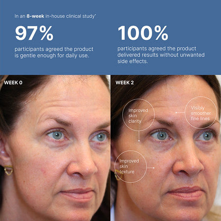 Tru Face Peptide Retinol Complex
