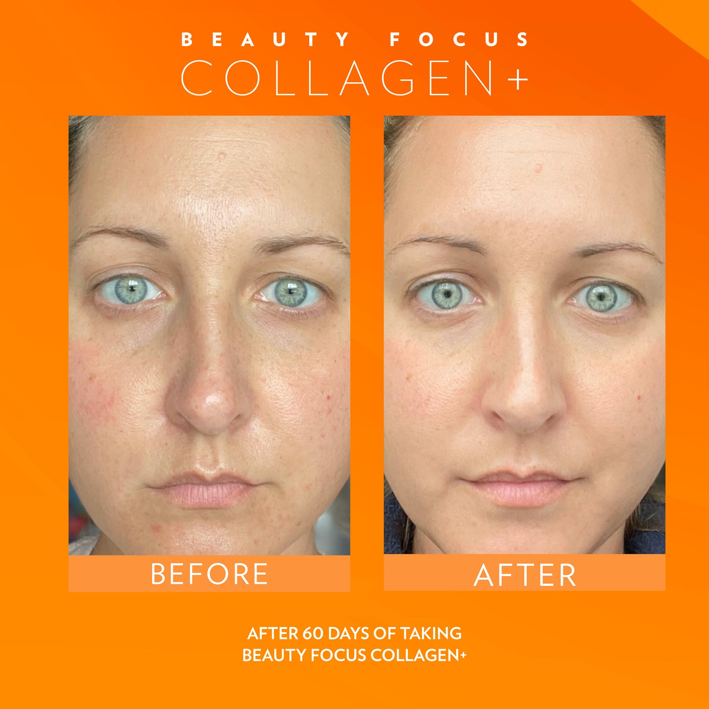 Beauty Focus Collagen+
