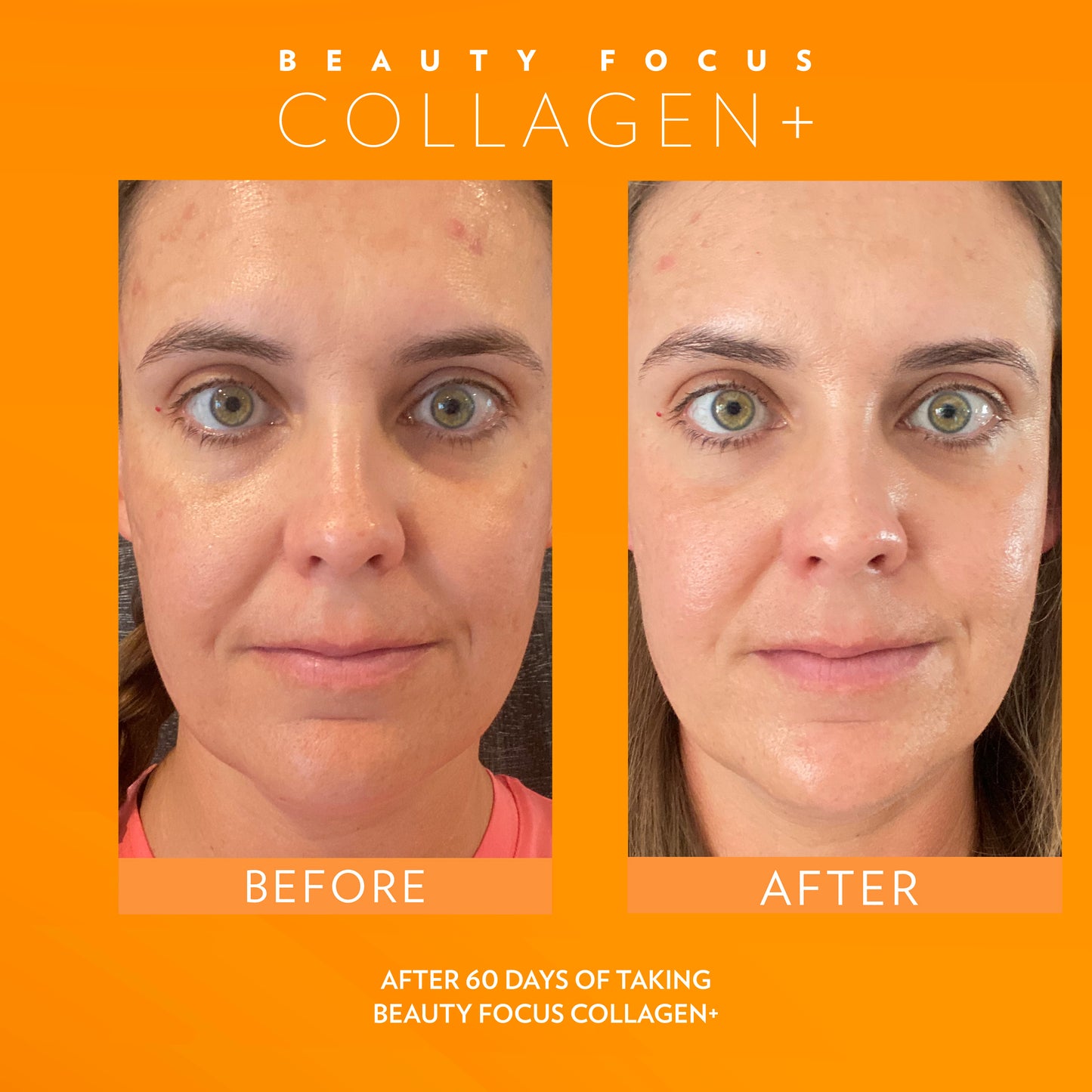 Beauty Focus Collagen+