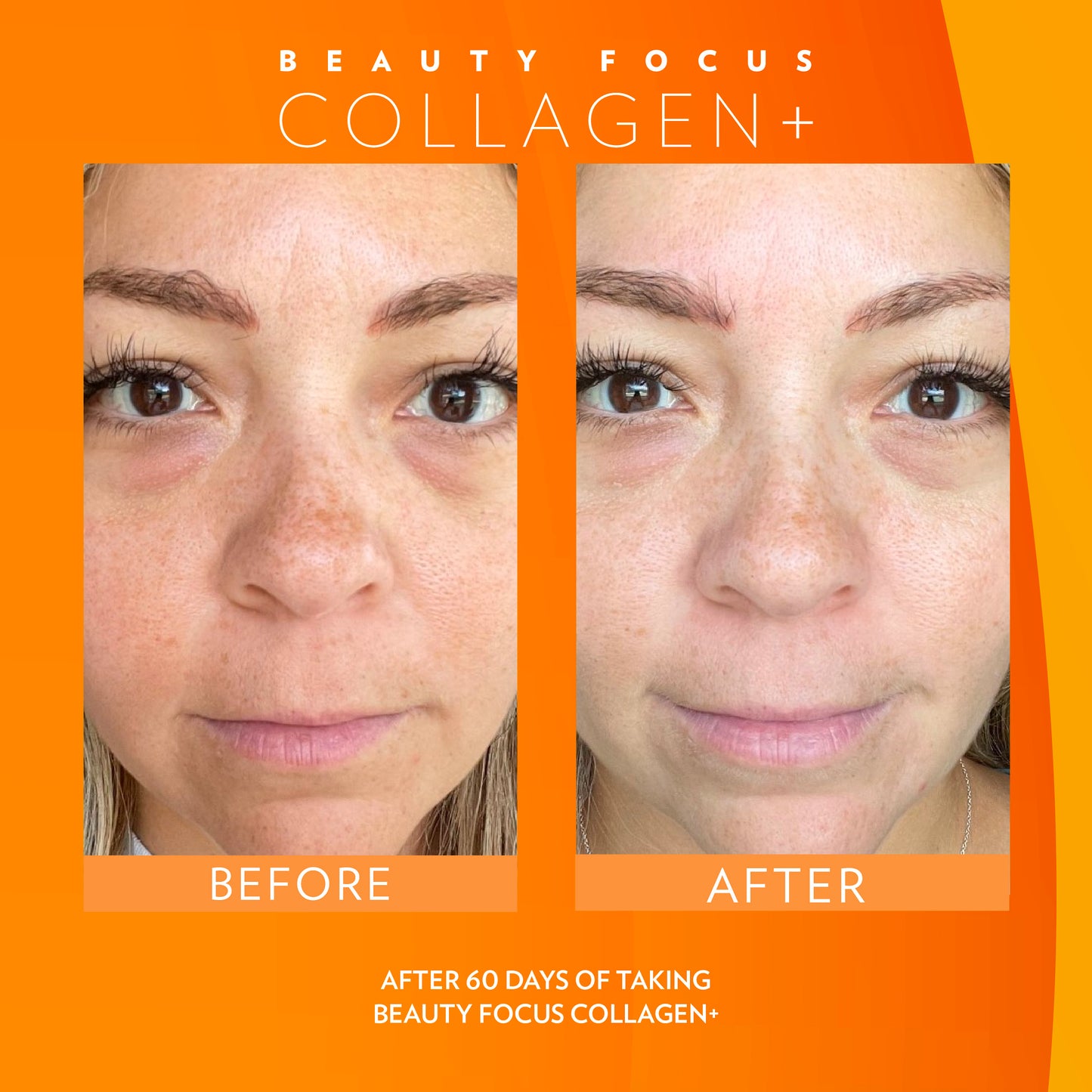 Beauty Focus Collagen+