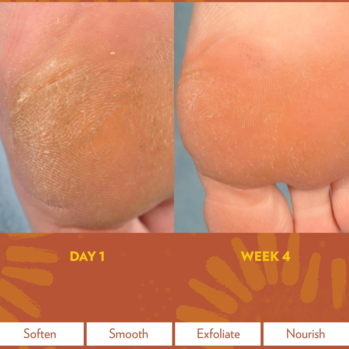 Epoch Sole Solution Foot Treatment