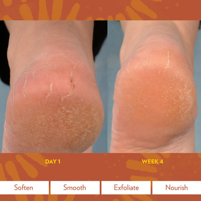 Epoch Sole Solution Foot Treatment